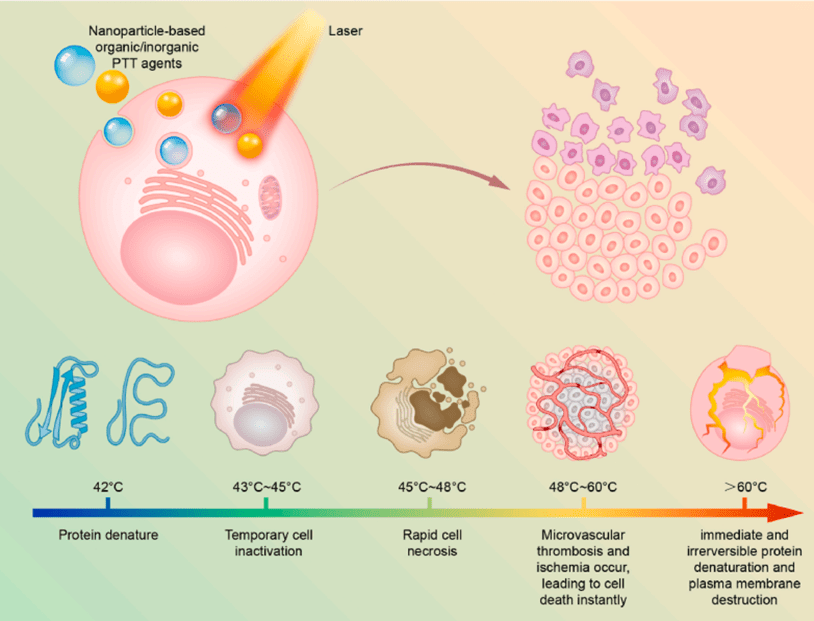 Phototherapy and its potential in cancer treatment OncoBites
