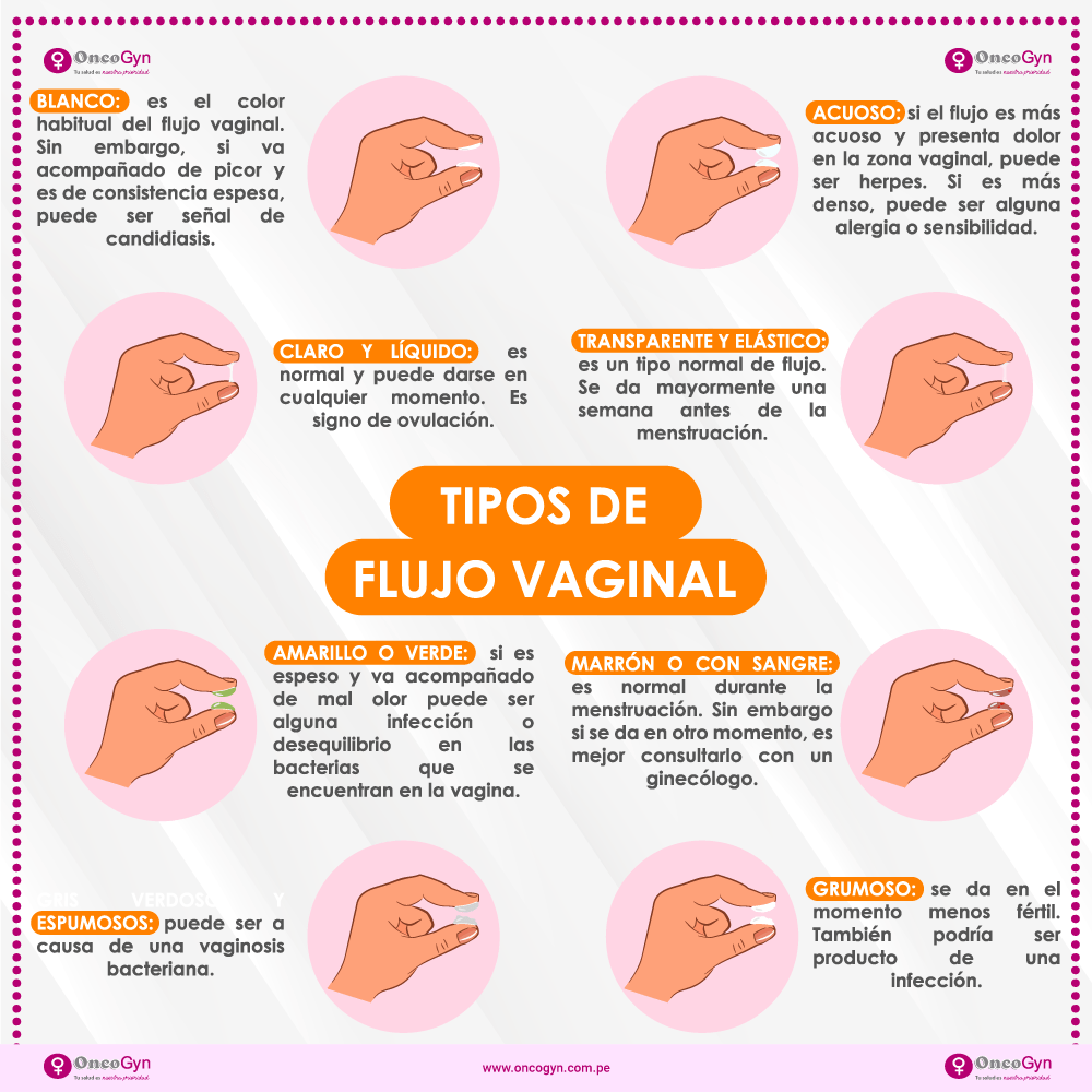 Flujo vaginal ¿qué indican sus cambios y cuándo preocuparse?