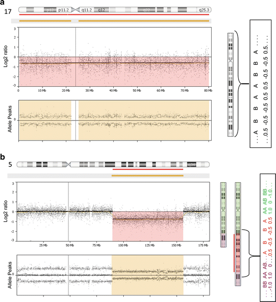 Application of Chromosomal Microarray Oncohema Key