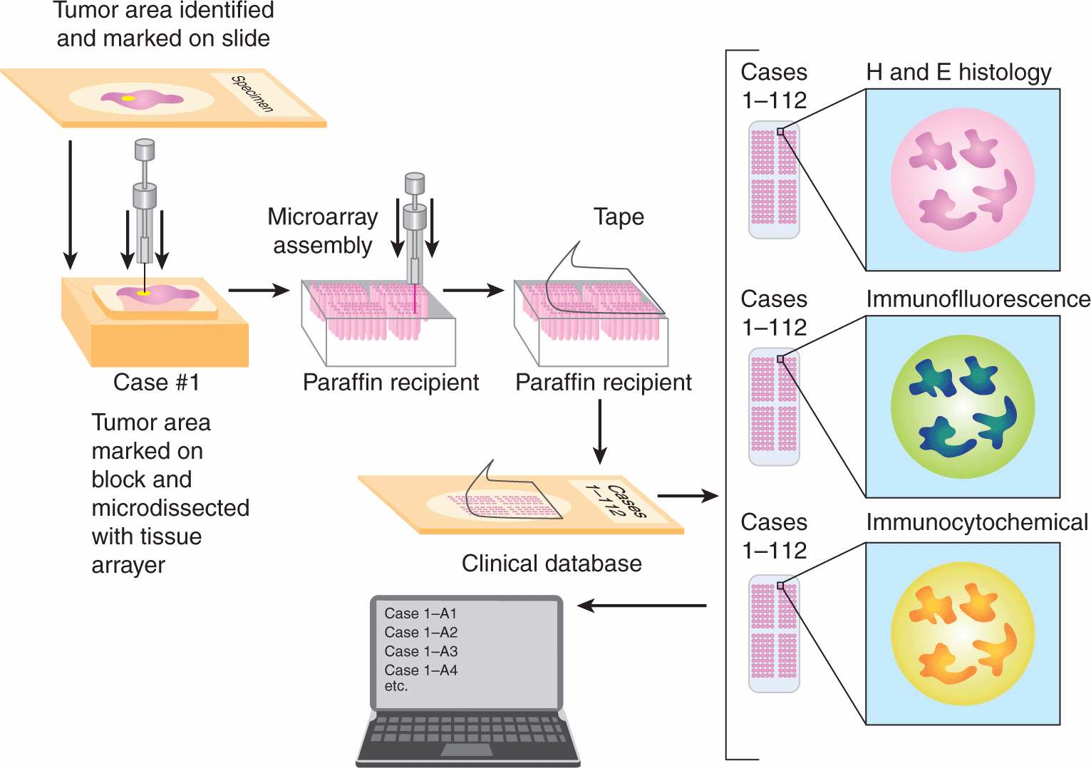 Methods of Molecular Analysis Oncohema Key