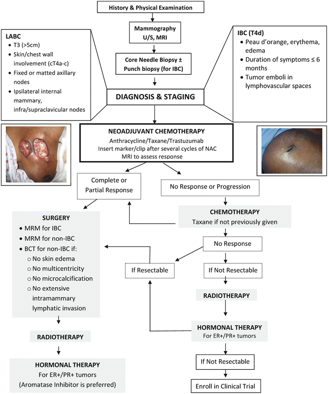 Icd 10 Pcs Code For Right Breast Biopsy