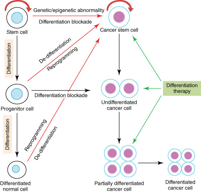 Differentiation therapy Oncohema Key