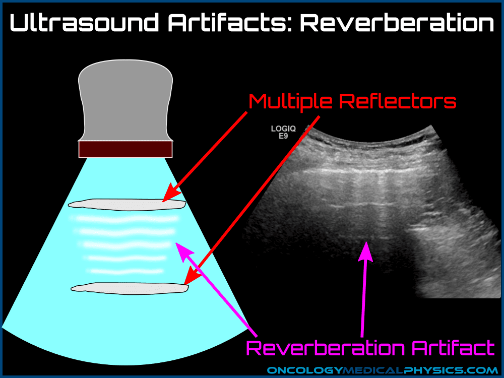 Ultrasound Oncology Medical Physics