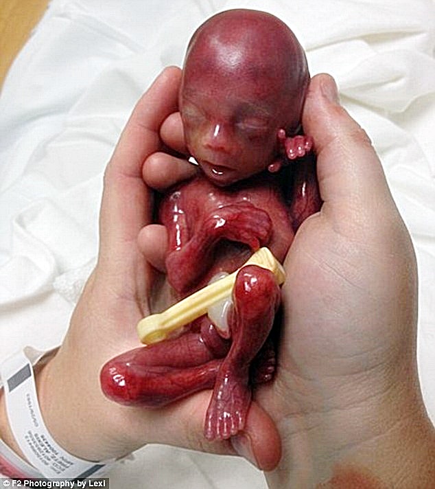 The Secret History of Planned Parenthood The