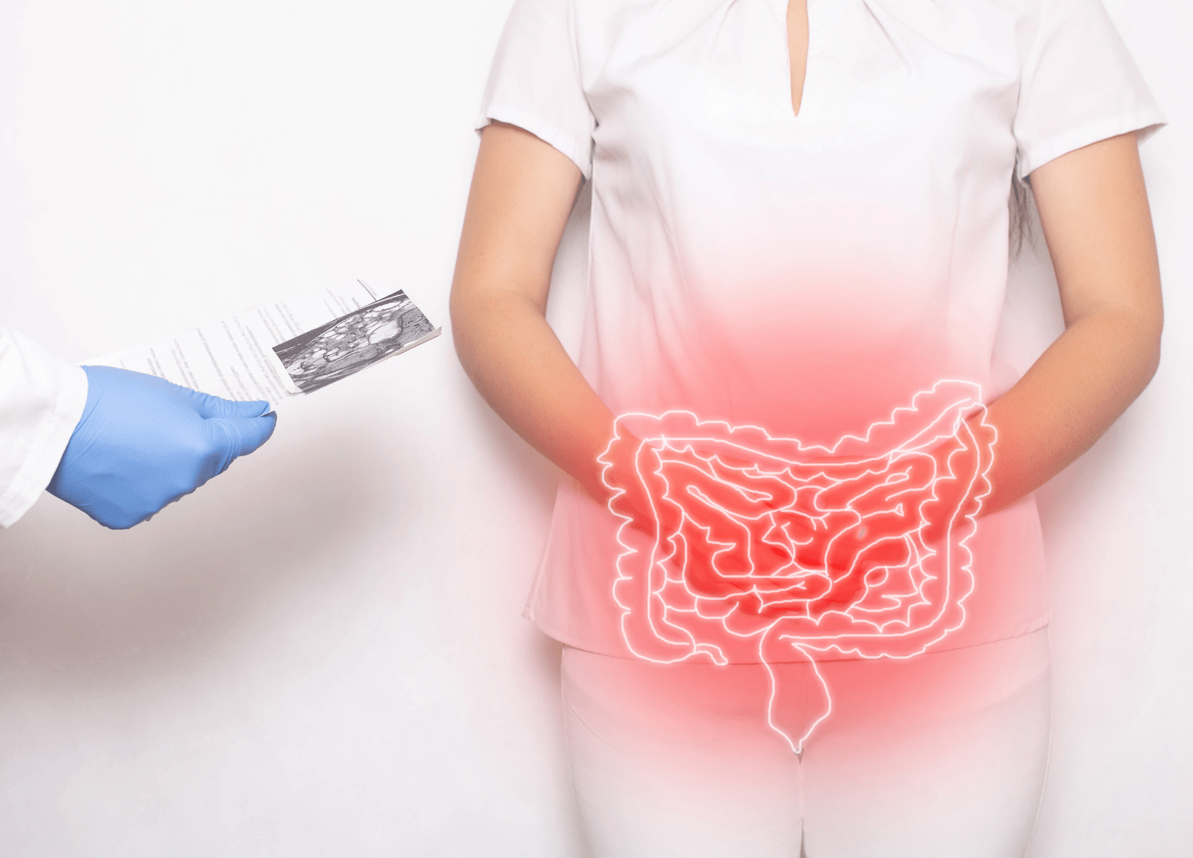 Ulcerative Colitis Digestive Health Conditions