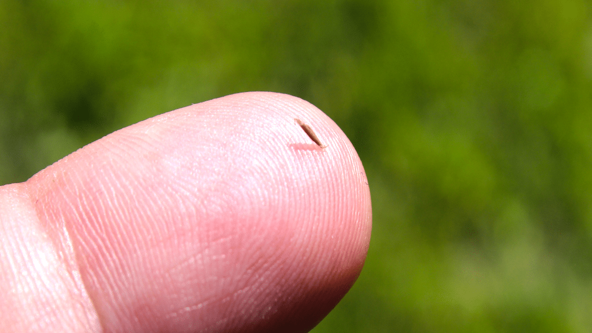 Descubre el significado de soñar con espinas en los dedos Experto en