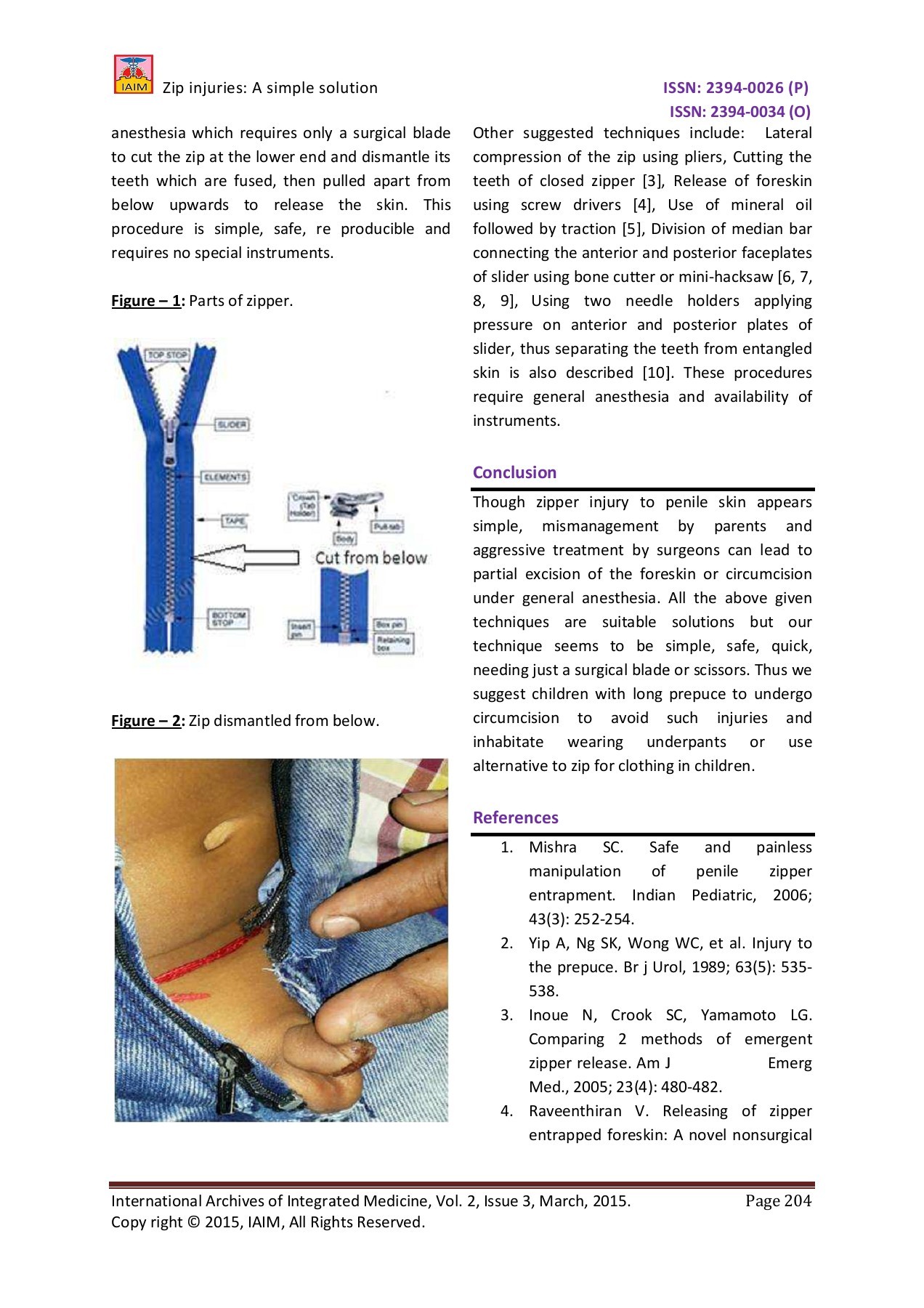 Figure From The Perils Of ZIpper‐Related Penile Injury, 54 OFF