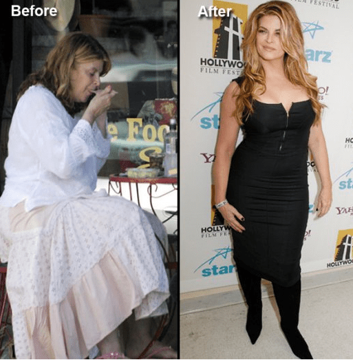 18 Most Dramatic Celebrity Weight Loss Transformation Page 14 of 18