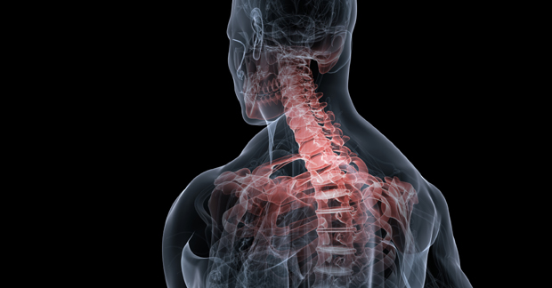 Your neck is out of alignment. What a crock of! OSP