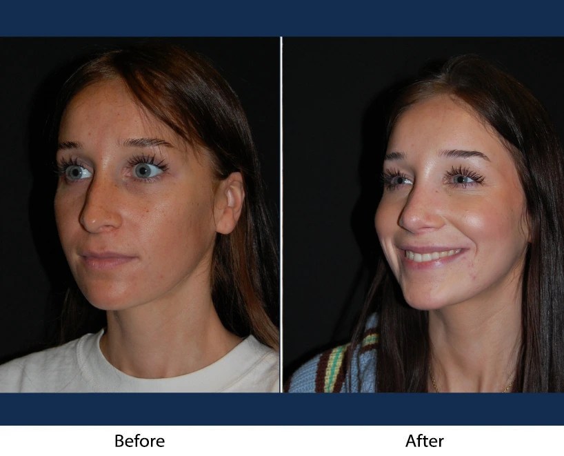 Case 02 | Before & After Result Photos