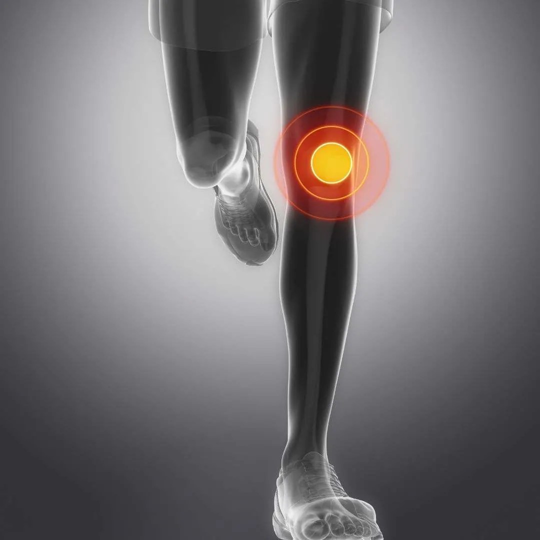 Dry Needling for Knee Pain in Richardson, Texas in 2023