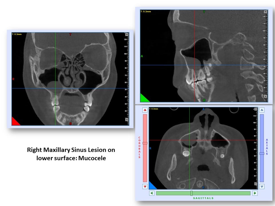 Ct Vs Cbct Dental Purchase For