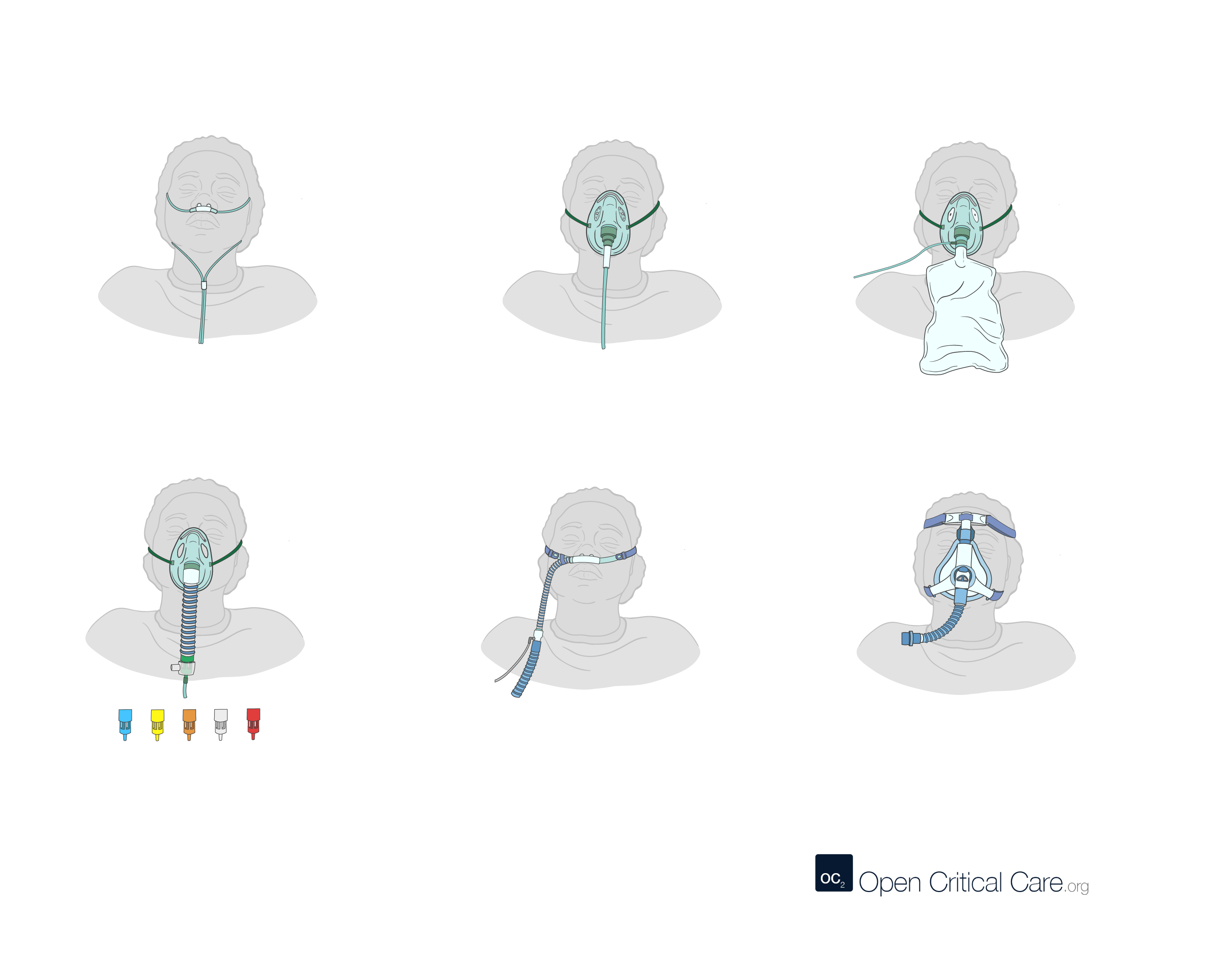 Noninvasive adult oxygen delivery devices Open Critical Care