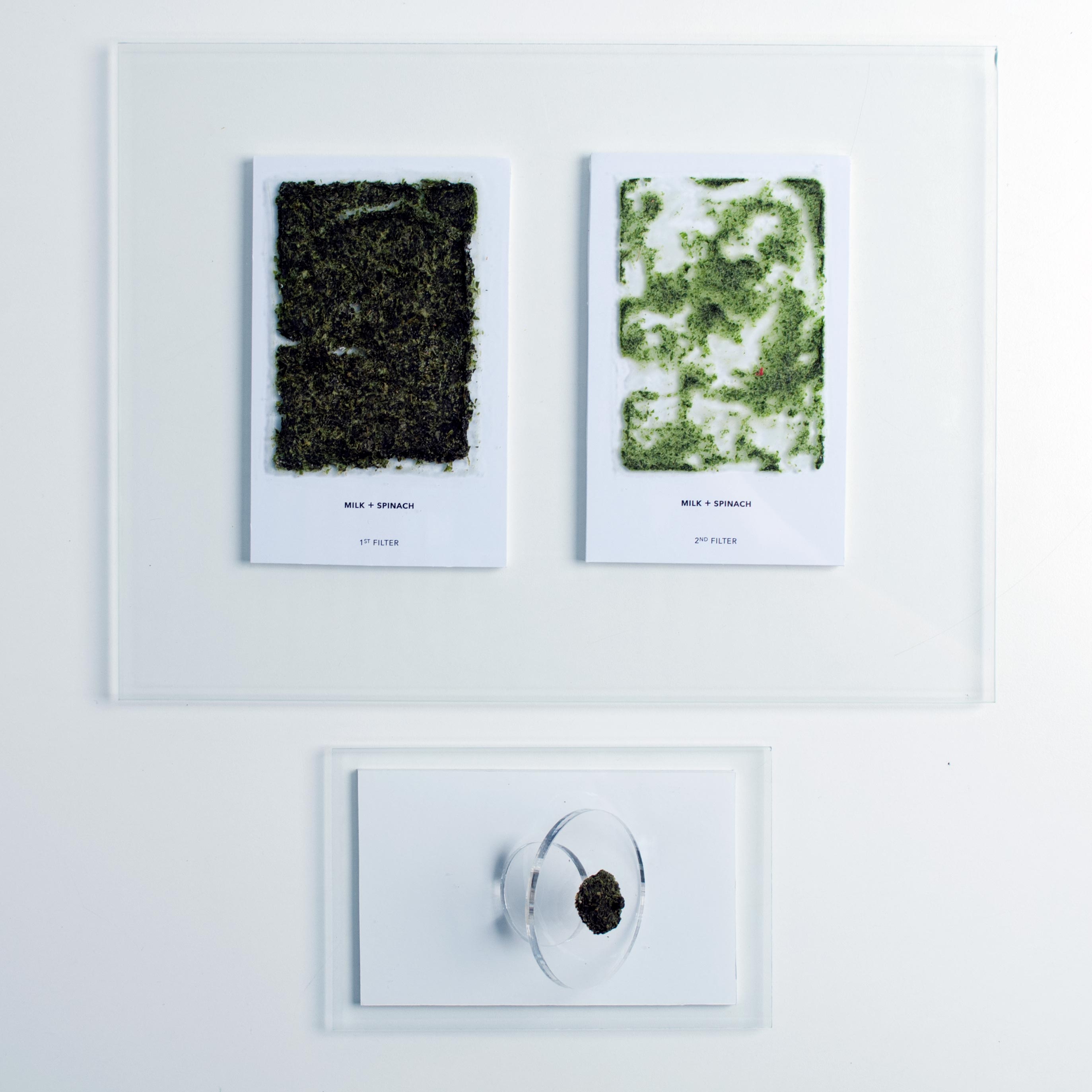 Kidney Stones Open Design Education