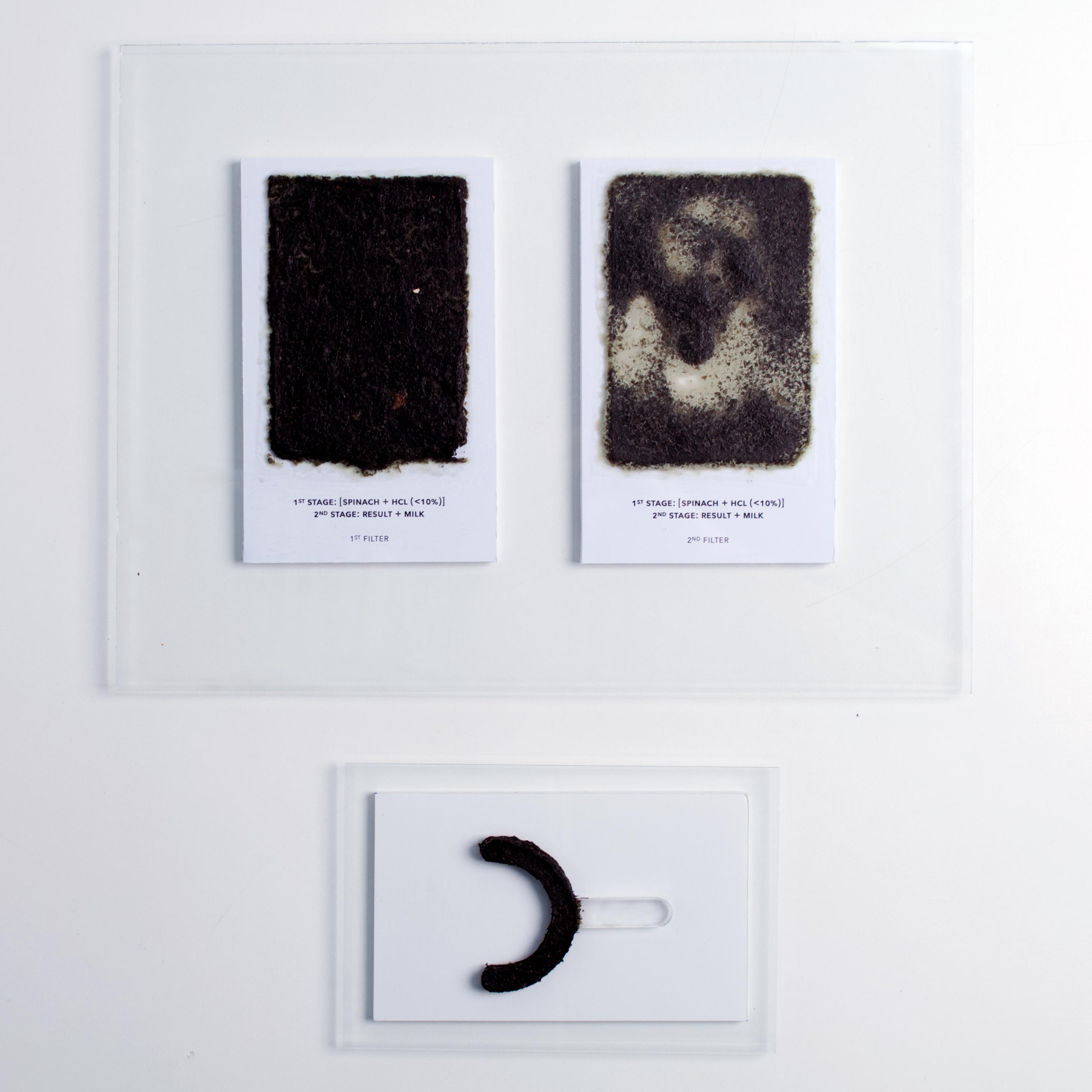 Kidney Stones Open Design Education