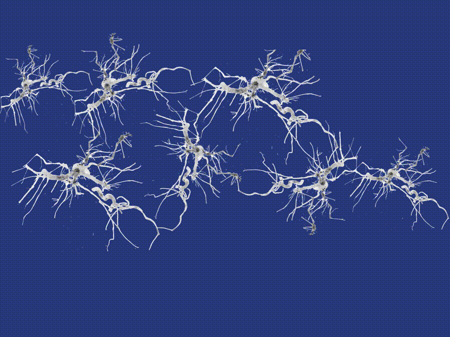 Brain neurons firing video background gif discoverygase