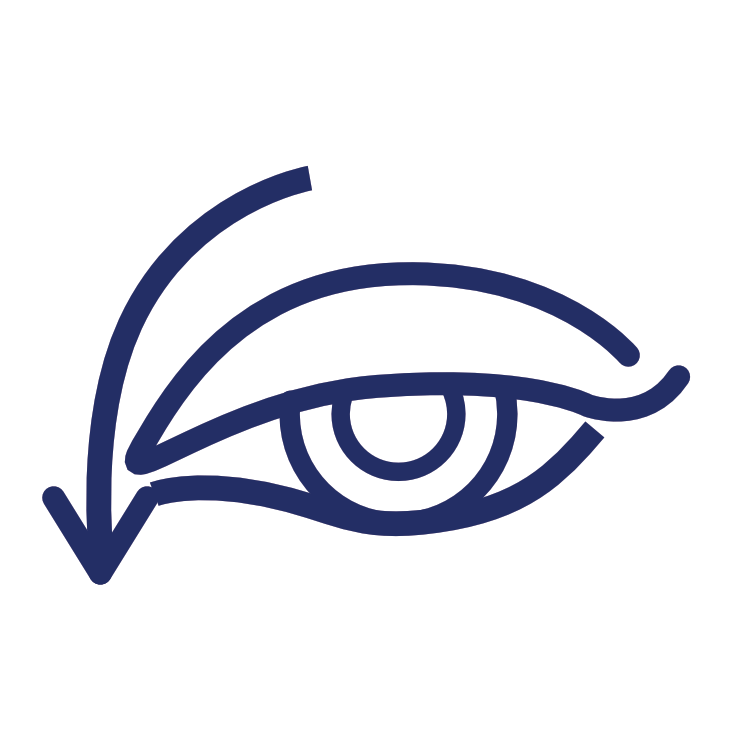 Learn More OPMD Association