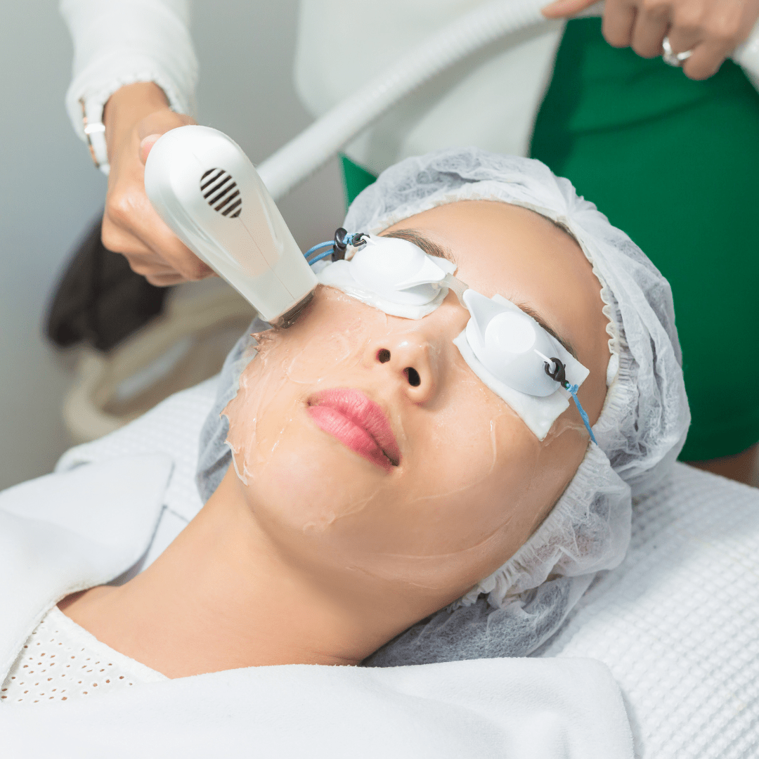 Intense Pulsed Light Laser (IPL) - opteluxewellness