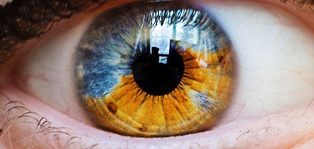 New laser eye procedure can turn brown eyes into blue! Laser Eye Surgery
