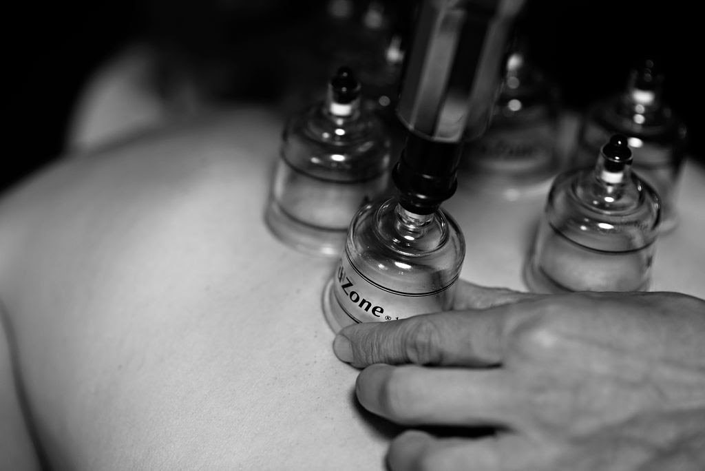 What is Cupping Therapy? Benefits of Cupping Therapy for Athletes
