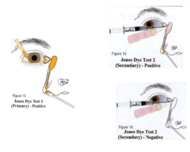 FLUORESENCE Optography