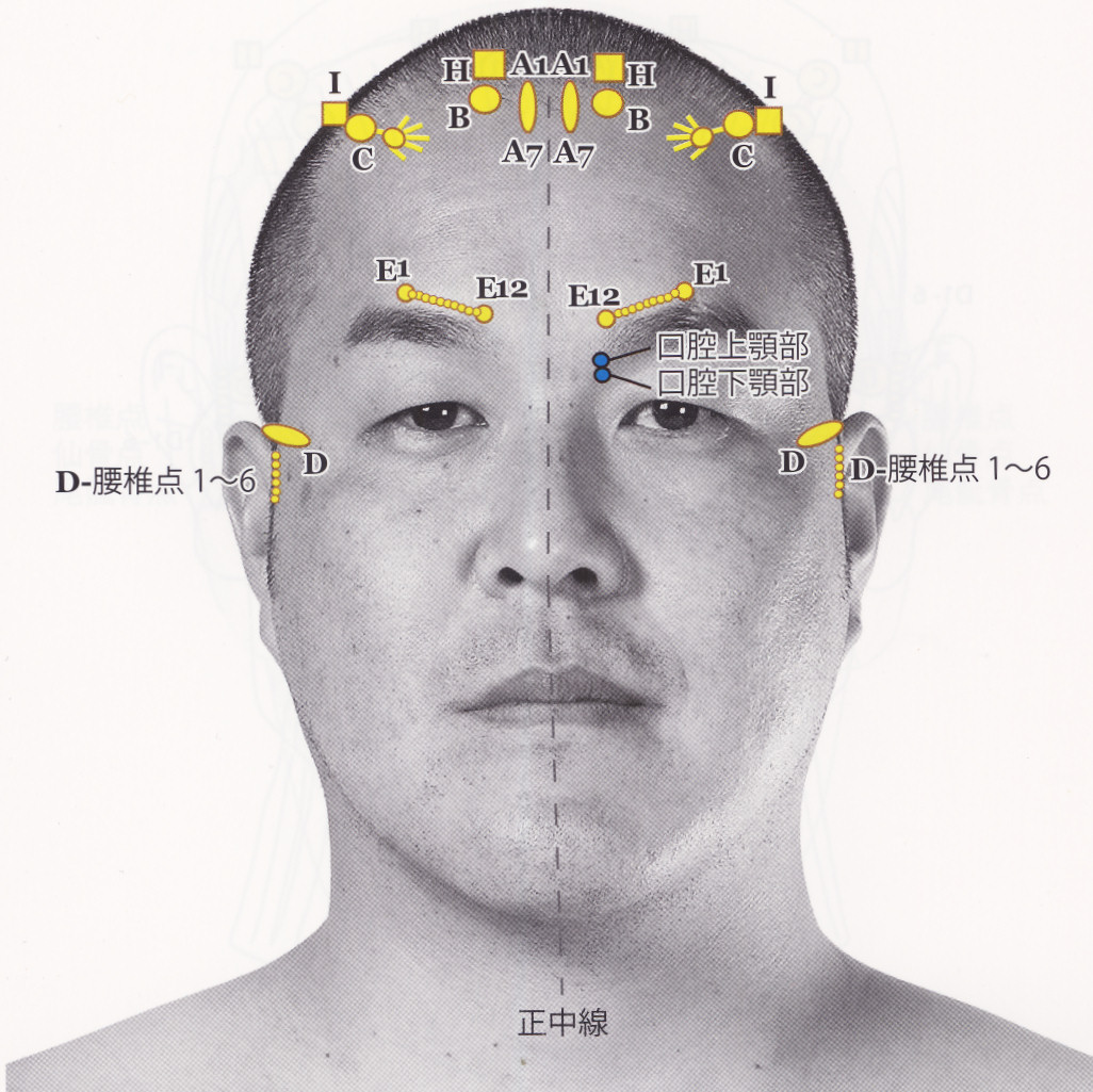 安いアウトレット店の売り上げ 山元式新頭針療法YNSA