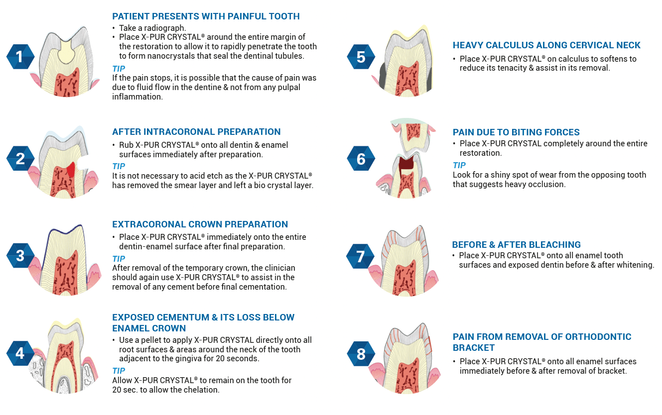 Oral Science XPUR Crystal