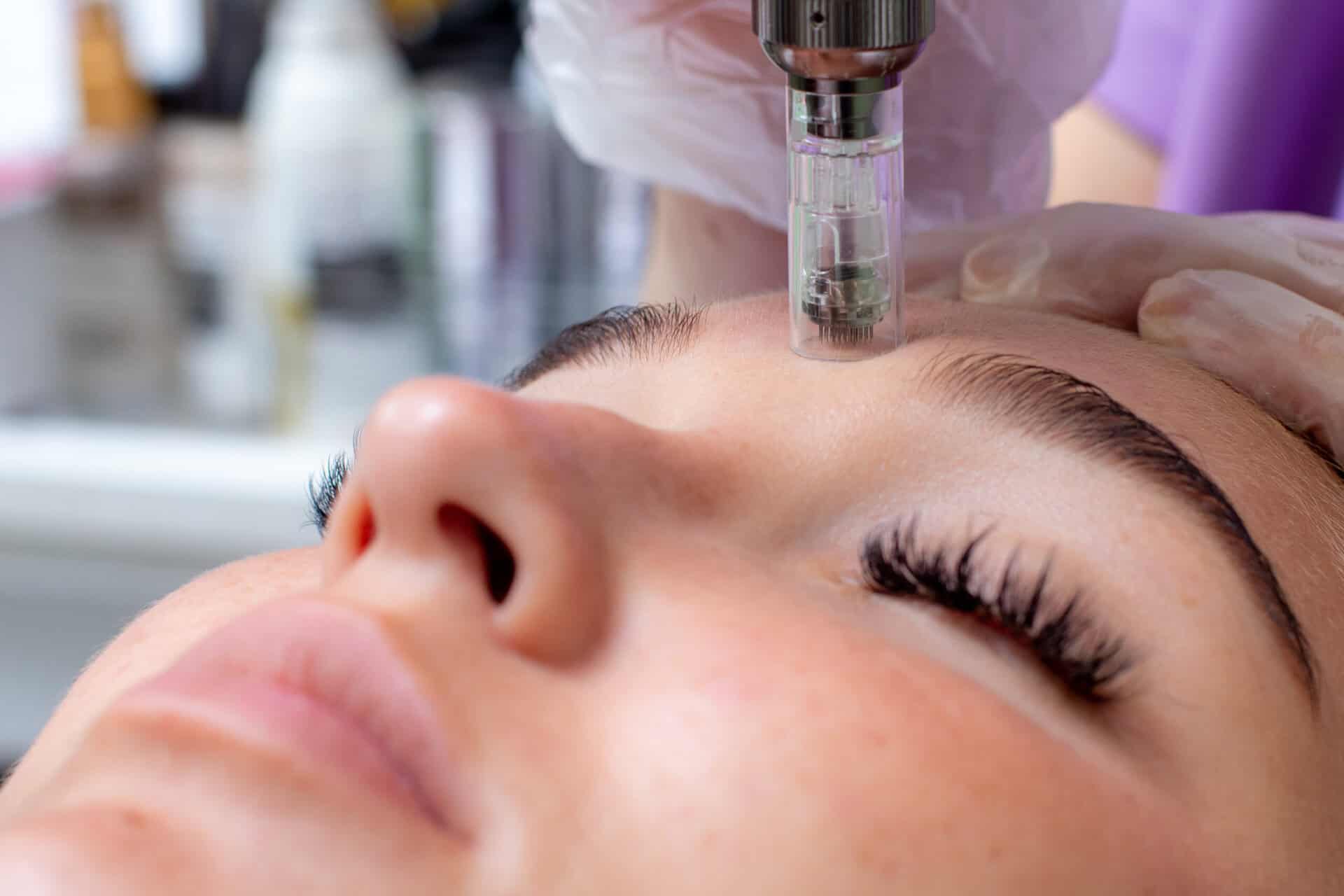 Microneedling Oral Facial Surgical Arts, PA