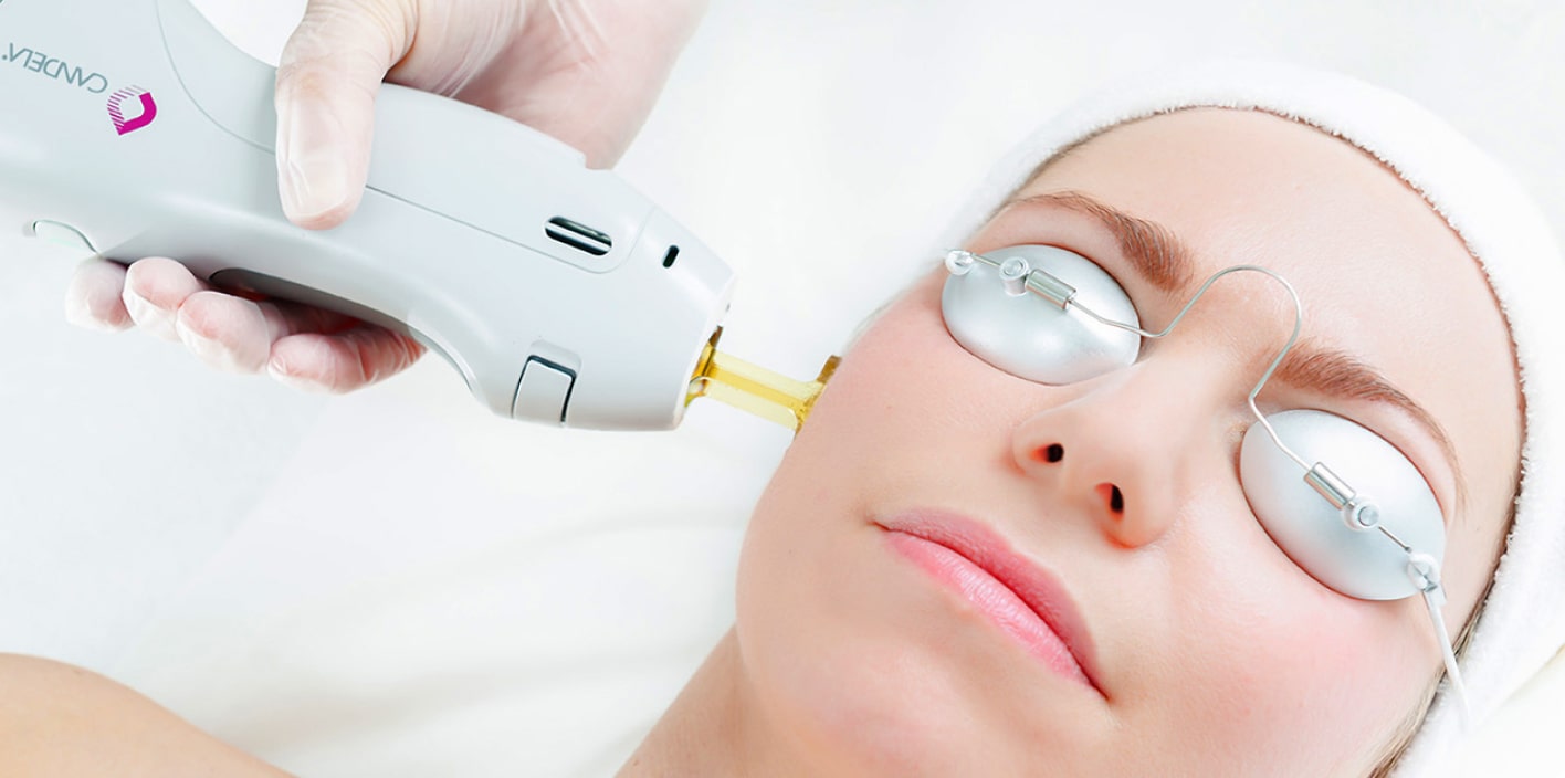 Láser NDYag Orange Medical