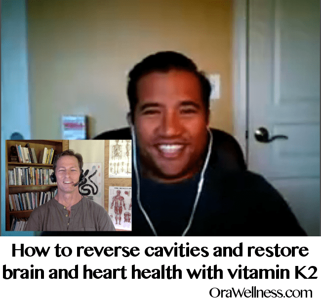 How to reverse cavities and restore brain and heart health with vitamin