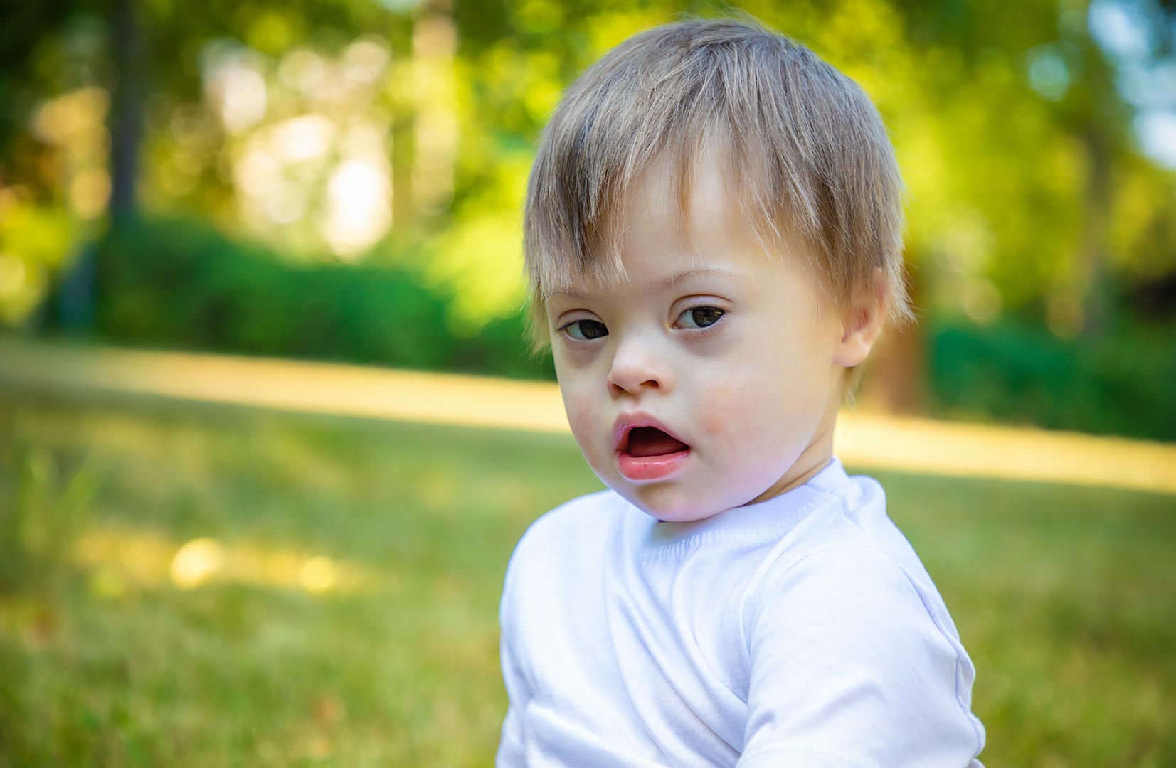 Down Syndrome Everything You Need to Know OrbRom Center