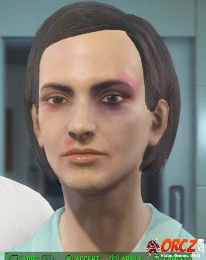 Fallout 4 Damage Boxer Black Eye The Video Games Wiki