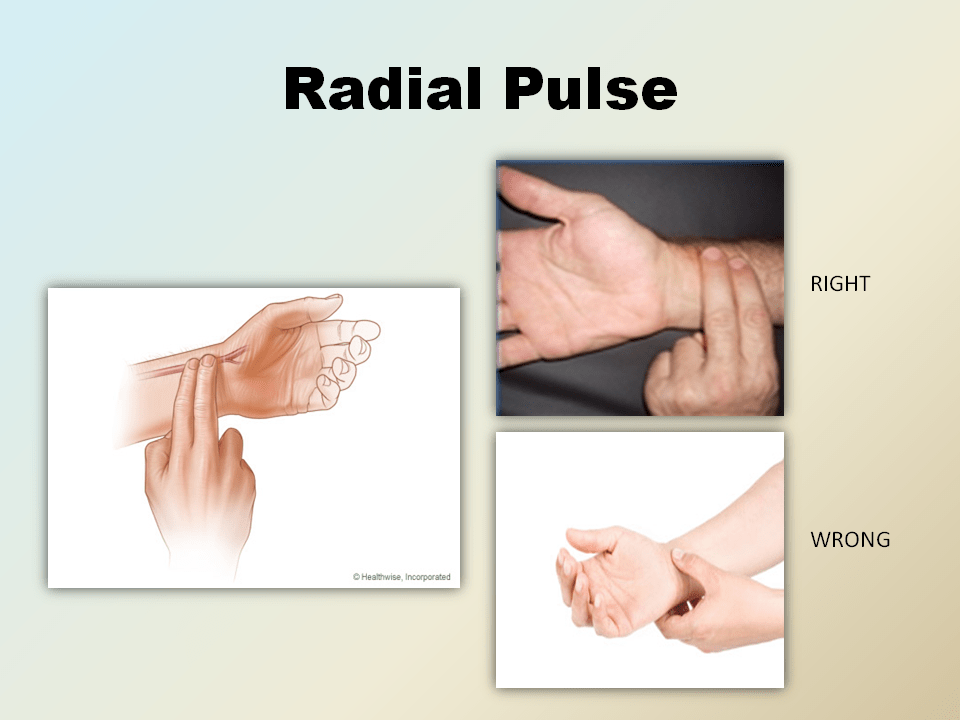 Radial Pulse