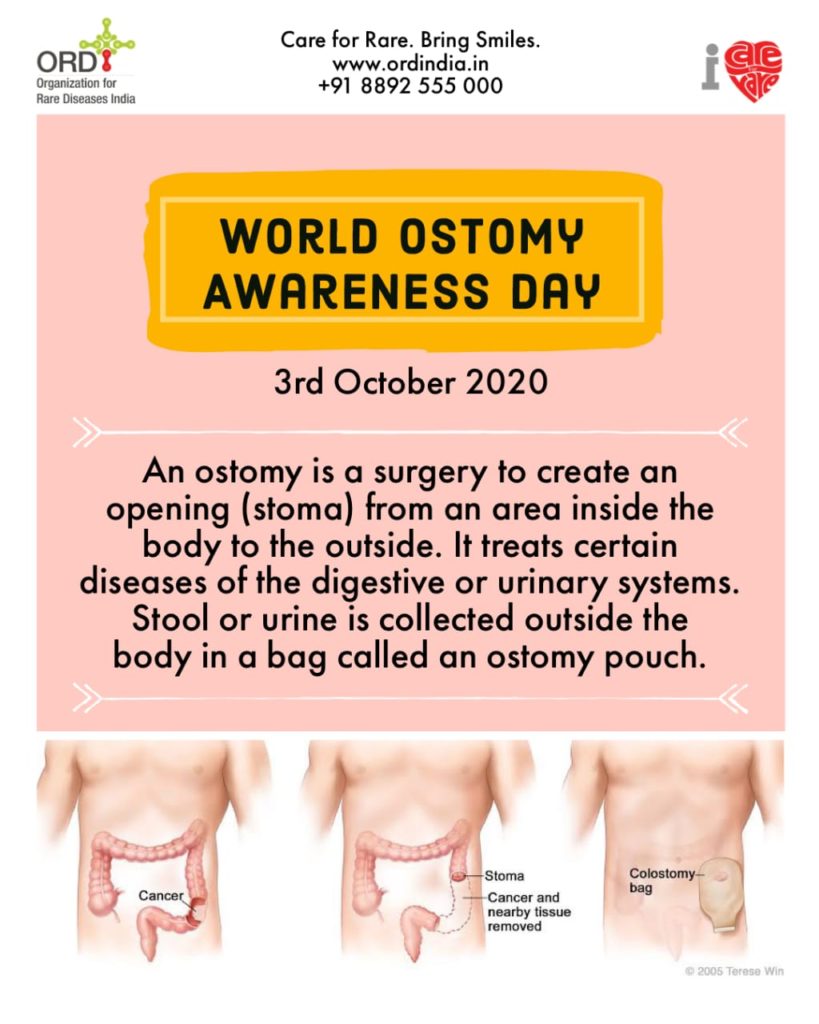 World Ostomy Day 2025 Activities Printable 3rd October World Ostomy Awareness Day ORD India