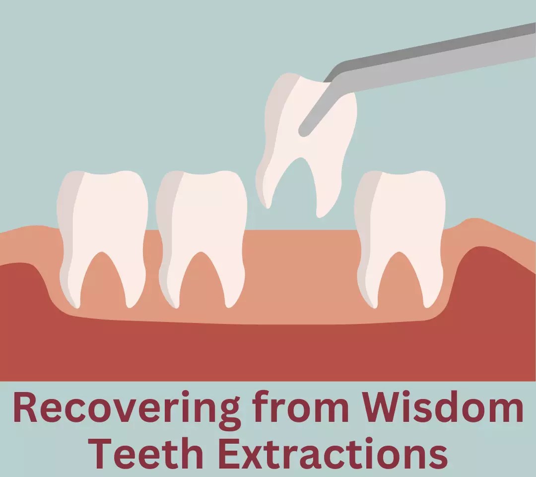 Tips for Recovering from Wisdom Teeth Extractions ORDNUR