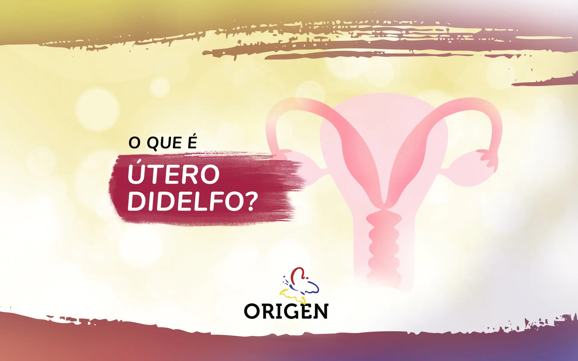 » O que é útero didelfo?