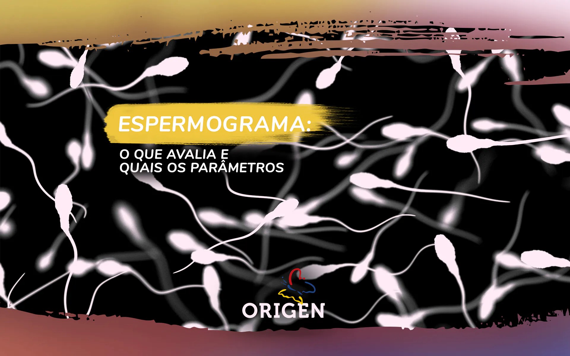 Tipos De Espermograma