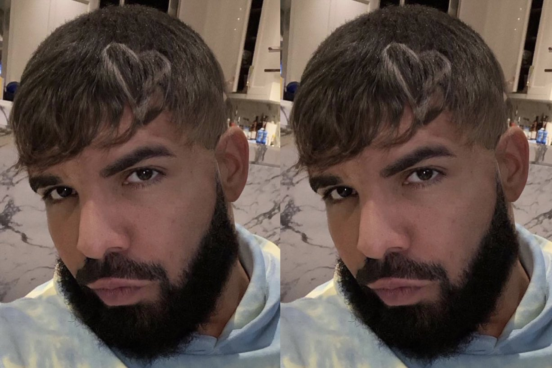10+ Drake'S New Hair BaljitAletta