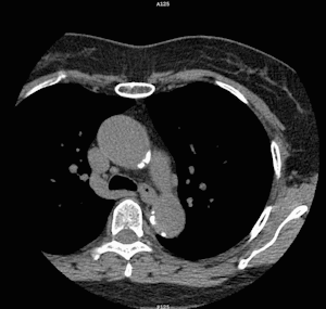 Ct Scanning – Cardiovascular Interventions Orlando