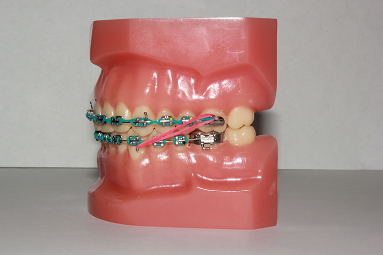 ELASTICS Orthodontic Specialists
