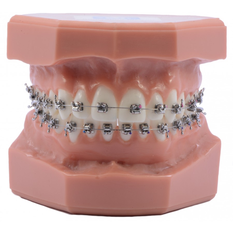 Bracket ActMIM Autoligado Activo