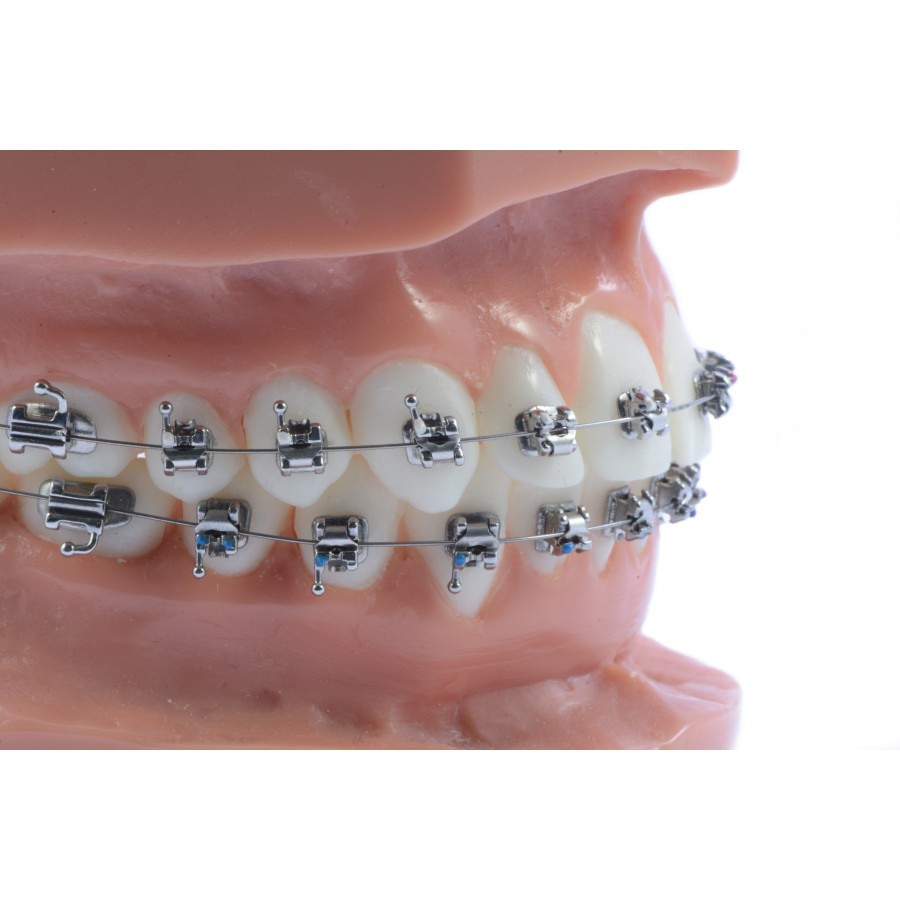 Bracket ActMIM Autoligado Activo