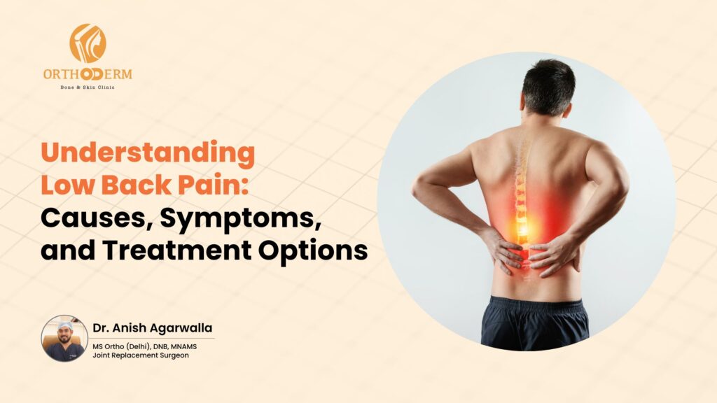 Understanding Low Back Pain Causes, Symptoms, and Treatment Options