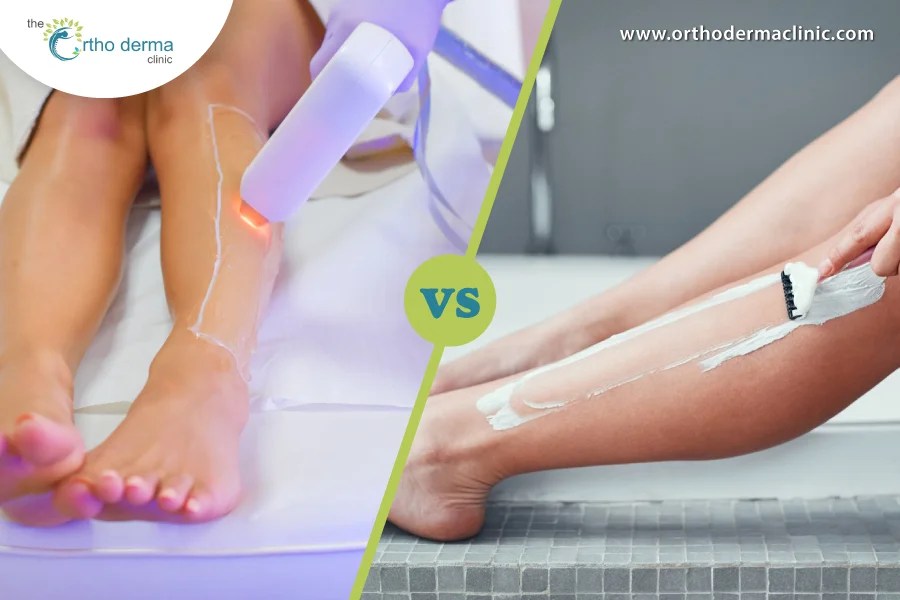 Laser Hair Removal vs. Traditional Hair Removal
