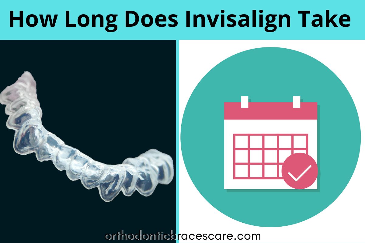 How Long Does Invisalign Take Invisalign Process