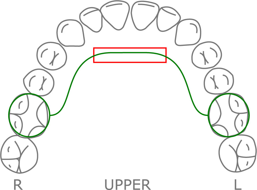 Bluegrass Habit Appliance Orthodontic Resource Group