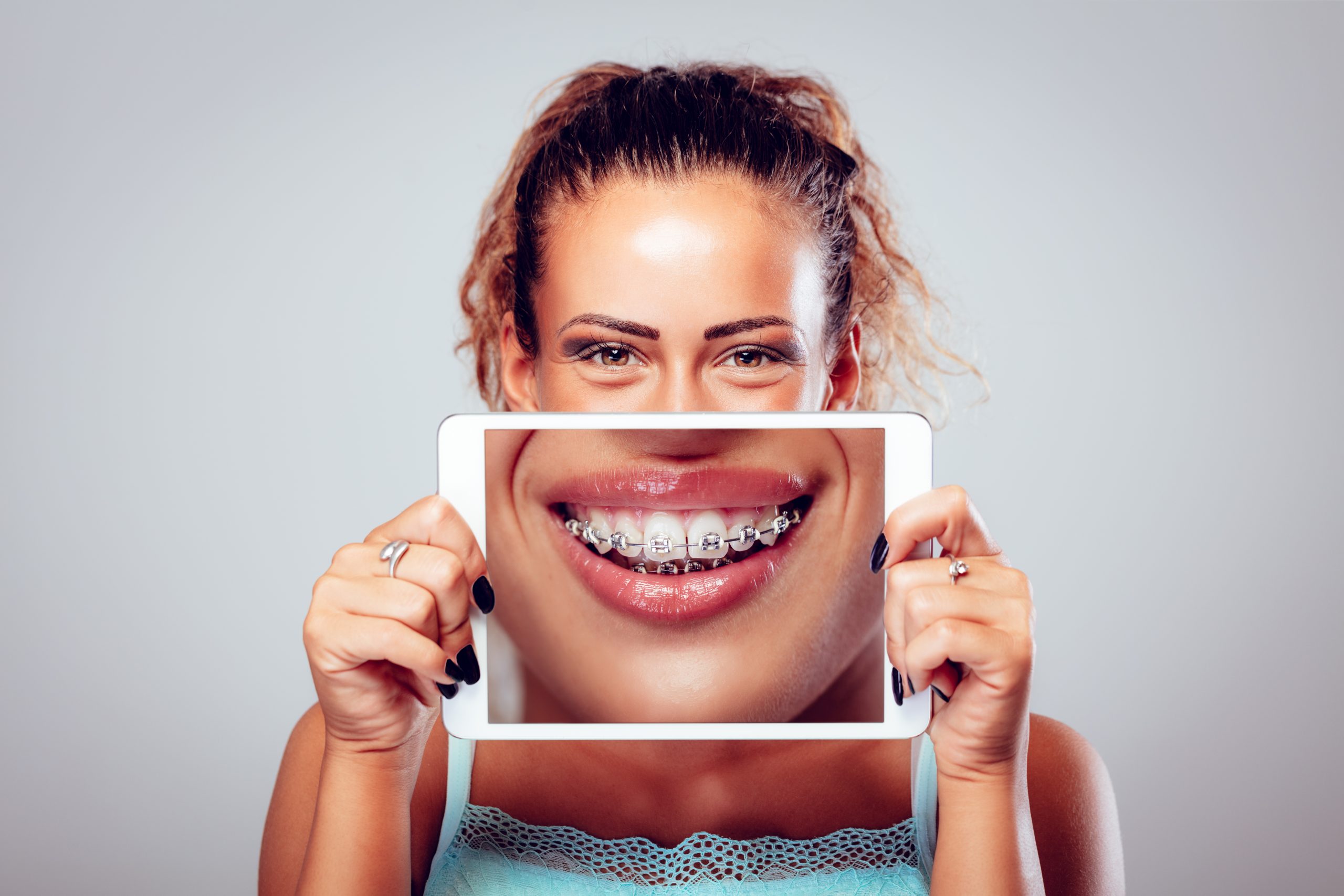 How Do Braces Work for Adults? Orthodontics For You