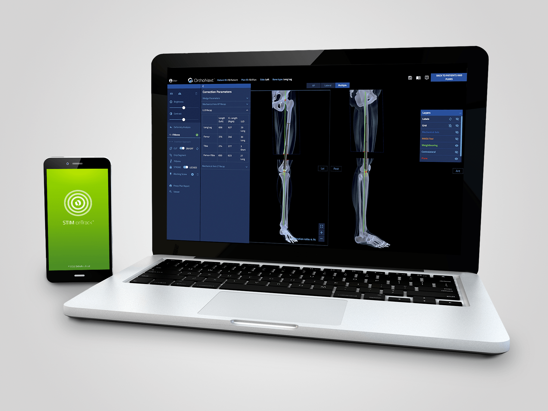 Spinal Medical Devices Orthofix