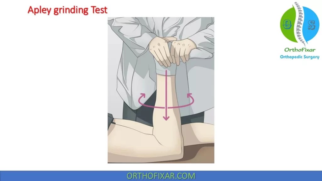 Apley Grinding Test OrthoFixar 2024