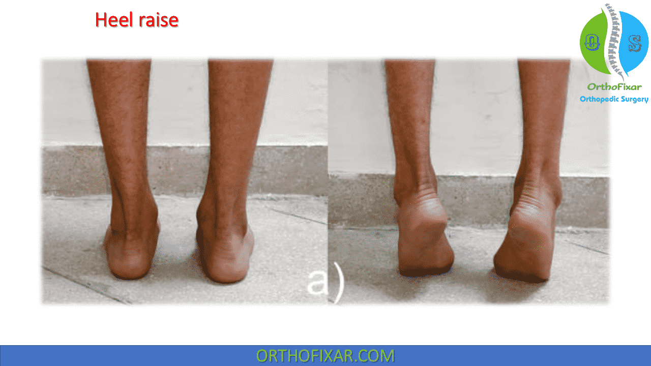 Details more than 112 heel rise test physical therapy super hot